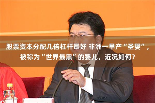 股票资本分配几倍杠杆最好 非洲一早产“圣婴”，被称为“世界最黑”的婴儿，近况如何？